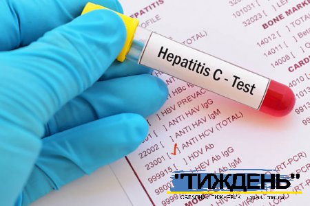 У Тростянці протягом тижня мешканців громади тестуватимуть на вірусні гепатити